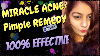 How To Remove PimplesAcne  Remove Acne Marks  Treatment at Home amp Instant Result  Jsuper Kaur [upl. by Sarad]