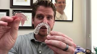 What Is The Best Orthodontic Retainer [upl. by Ketchum]