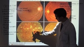 Retinopatía Diabética  Tipos y Tratamiento  Patología Ocular [upl. by Luo]