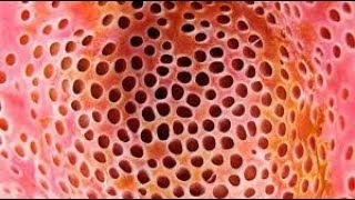 Trypophobia Test 1 [upl. by Lubow]