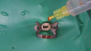 3 Obturation canalaire  thermocompactage Endodontie [upl. by Llehsor]