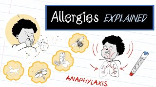 What are Allergies HealthSketch [upl. by Chapell946]