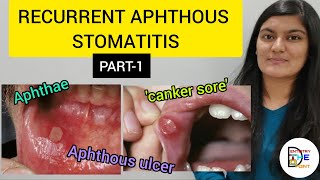 RECURRENT APHTHOUS STOMATITIS RAS PART1 [upl. by Alaham]