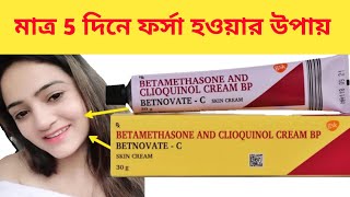 BETNOVATE C SKIN CREAM ফর্সা হবার উপায়  BETNOVATE C CREAM BANGLA REVIEW [upl. by Krystal]