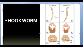 Ancylostoma duodenale [upl. by Carbone]