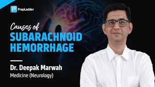 Causes of Subarachnoid Hemorrhage by Dr Deepak Marwah [upl. by Aixela]