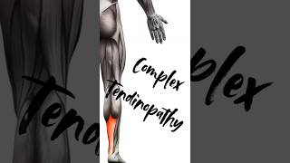 letstalkabout complex tendinopathy sports sportsmedicine sportsdoctor sportsinjury fyp [upl. by Sherard137]