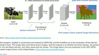 Medical Image Segmentation Using SegNet in Matlab IP Credit in description [upl. by Yknip]