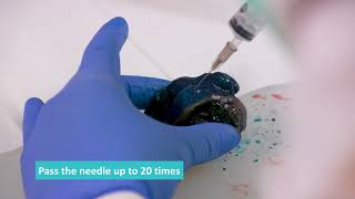 Fresh Tissue Sampling  Fine Needle Aspirate FNA Technique [upl. by Doralin]