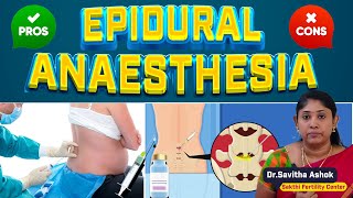 Epidural  Benefits amp Side Effects of Anesthesia During Labor [upl. by Chadd854]