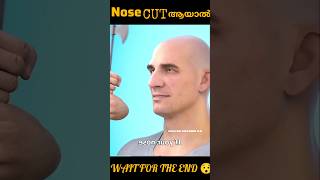 Nose cut ആയാൽWAIT FOR THE END 😯 [upl. by Kenlay]