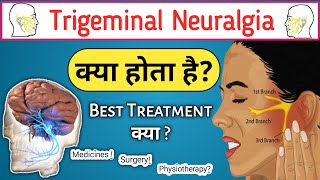 trigeminal neuralgia  trigeminal neuralgia Symptoms  trigeminal neuralgia in hindi [upl. by Erdnua]