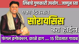 उष्णता एका दिवसात कमी करा  Dr Swagat Todkar  gharguti upchar घरगुती उपाय [upl. by Limaa]