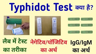 Typhidot test  Typhoid test  typhidot igm igg positive means in hindi [upl. by Valonia]