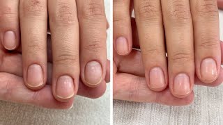 Results are in From cutting the skin fold to gentle manicures 3 week progress [upl. by Hutson]