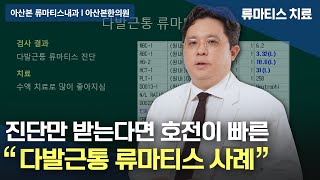 류마티스내과 다발근통 류마티스는 진단받는 것이 가장 중요합니다 l 서울류마티스내과 [upl. by Ag]