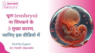 भ्रूण embryo ना चिपकने के 5 मुख्य कारण जानिए इस वीडियो में  Dr Parth Bavishi [upl. by Ludmilla]