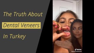 The Truth about Dental Veneers in Turkey [upl. by Akieluz]