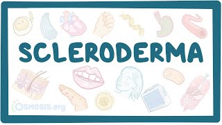 Scleroderma  an Osmosis Preview [upl. by Varini492]