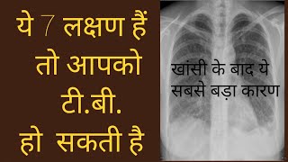 टीबी के लक्षण और उपचार  Tuberculosis Symptoms Causes Prevention Treatments  TB Symptoms In Hindi [upl. by Neirbo]