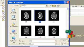 Final Year Projects  MRI BRAIN IMAGE SEGMENTATION USING MODIFIED FUZZY CMEANS CLUS [upl. by Skeie]