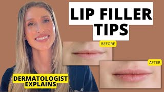 Dermatologist Shares 9 Lip Filler Tips to Know Before and After Treatment [upl. by Aniral]