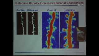 New Mechanisms Elicited with Ketamine in TreatmentResistant Depression [upl. by Eslek]