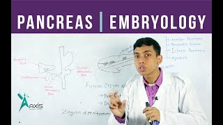 Pancreas Development Congenital Anomalies  বাংলা [upl. by Aisayt]