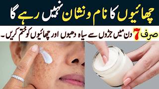 صرف 7 دنوں میں جھائیوں سے نجات پائیں I Reduce Melasma I Pigmentation I Discolouration I Blackspots [upl. by Tnek]