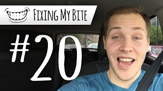 I Got My Braces Off  Fixing My Bite Part 20 [upl. by Svend]