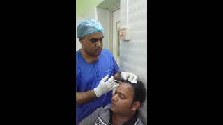 PRP therapy for Hair loss treatment [upl. by Aizitel]