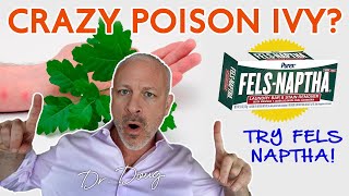 POISON IVY CURE Fels Naptha  Dr Doug Willen [upl. by Asilam]