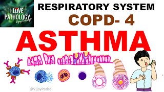 Chronic Obstructive Pulmonary Disease Part 4 Asthma  Etiopathogenssis amp Pathology [upl. by Lyreb98]