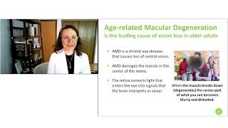 Age Related Macular Degeneration Risk Reduction and Improved Treatment Outcomes [upl. by Nay]