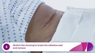 How to Apply and Remove Aquacel® Ag Surgical Dressings CSection [upl. by Naval693]