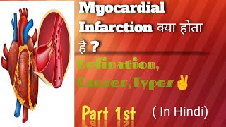 Myocardial Infarction or Heart Attack  part 1st in Hindi DefinationRisk CausesTypes [upl. by Atthia]