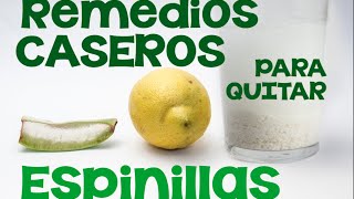 3 remedios caseros para quitar las espinillas barros y puntos negros de la nariz cara y espalda [upl. by Miguela492]