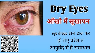 Dry Eyes  Ayurveda eye treatments  Dr Bharat Bhushan [upl. by Krauss642]