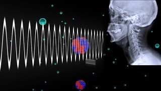 How Do Xrays Work [upl. by Apgar709]