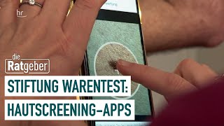 Wie gut ist ein Hautscreening per App  Die Ratgeber [upl. by Slater]