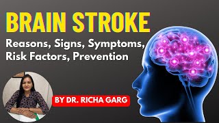 Brain Stroke  Reasons  Risk factors Prevention  Brain clot  Brain Haemorrhage By DrRicha Garg [upl. by Solim]