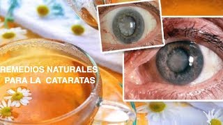 REMEDIOS Naturales PARA LAS CATARATAS [upl. by Onairelav]