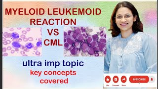 LEUKEMIACML vs LEUKEMOID REACTION VIMP topic for ugpg neetpg inicet pathologyconcepts [upl. by Korman]