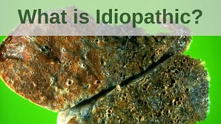 What is Idiopathic  Pathology mini tutorial [upl. by Kerrison]