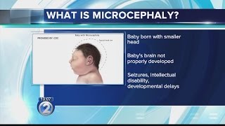 What is microcephaly [upl. by Oglesby284]