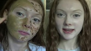 DIY face mask for redness [upl. by Nosyaj255]