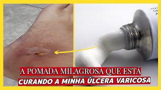 A POMADA MILAGROSA QUE ESTÁ CURANDO A MINHA ÚLCERA ulceravaricosa [upl. by Atina]