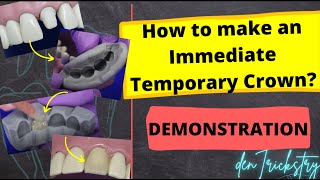 How to make an IMMEDIATE TEMPORARY CROWN Direct Temporization Technique  Demonstration [upl. by Lillywhite736]