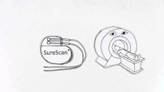 Medtronic SureScan® MRI [upl. by Amahs]