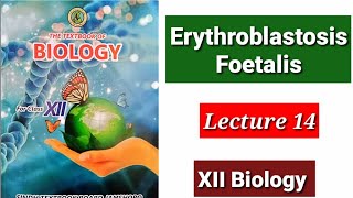 Erythroblastosis Foetalis Lecture 14 [upl. by Schug]